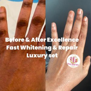 Excellence customised combo products