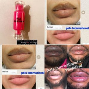 Pels pink lip balm. Very effective