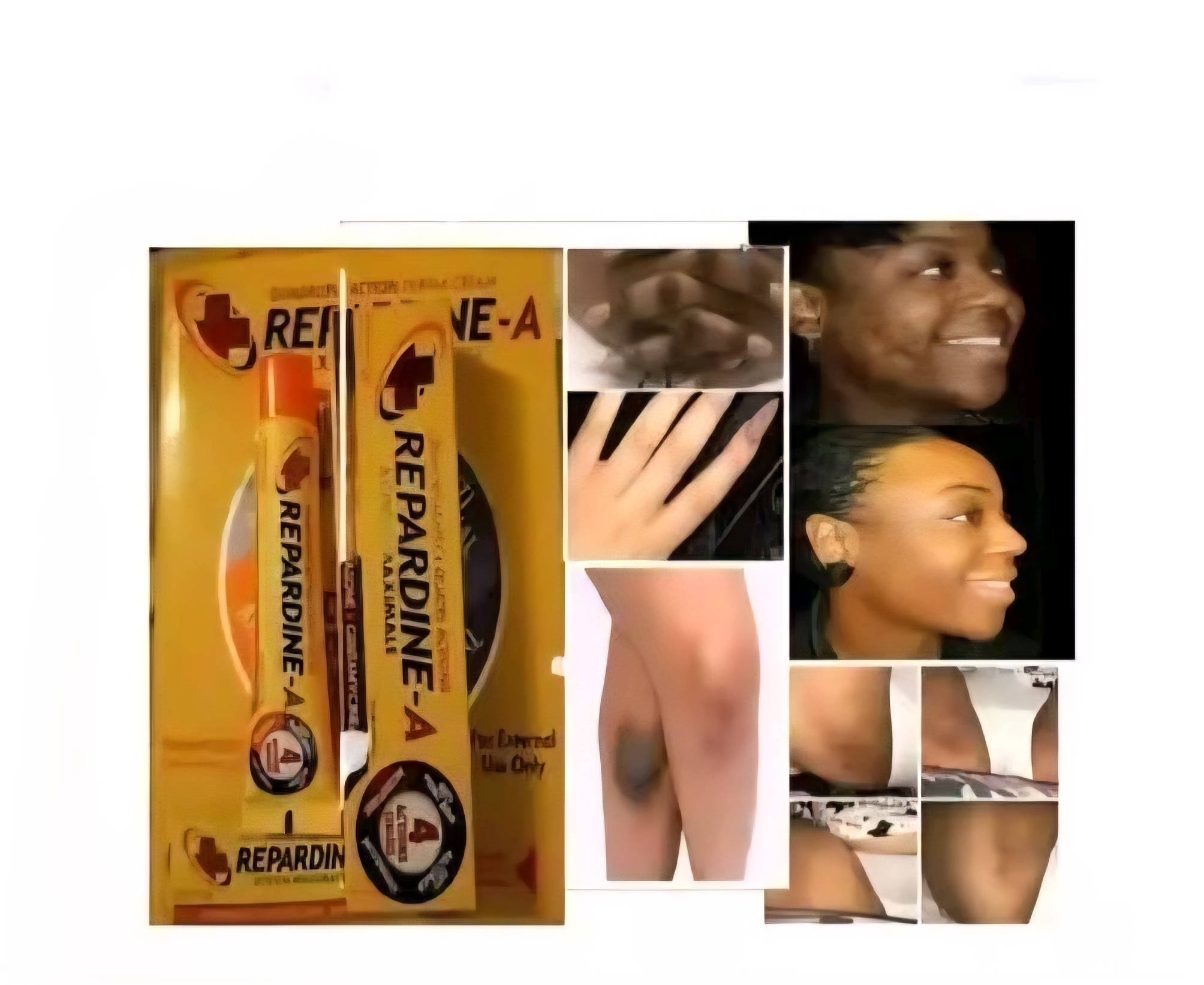 Repardine-A Anti Fungal,Anti Bacterial,Anti inflammatory cream.very powerful 30g - Image 2