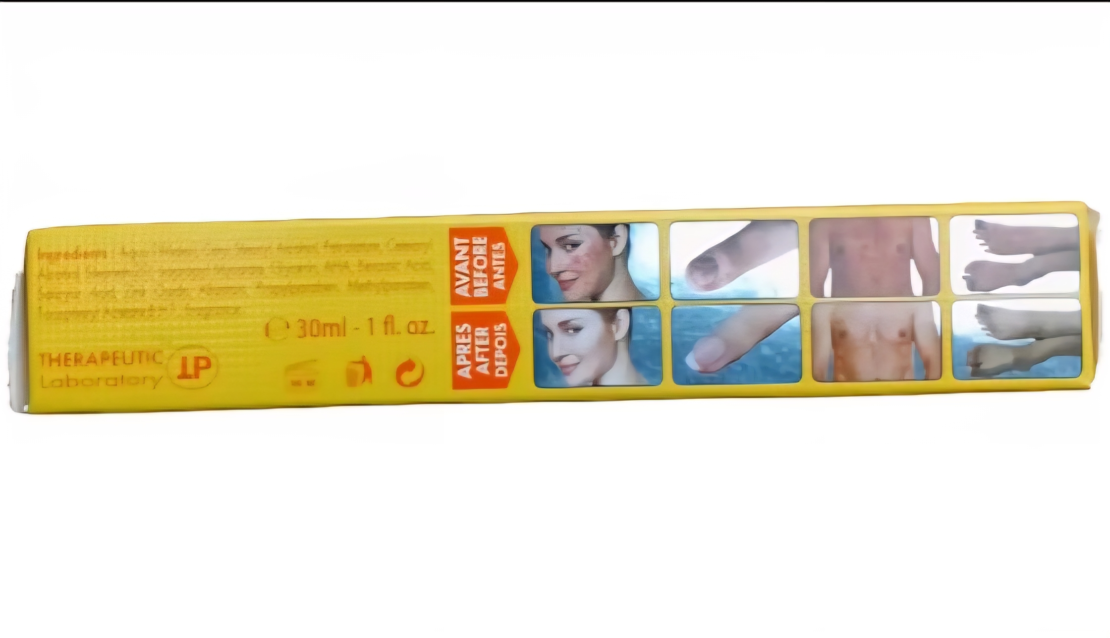 Repardine-A Anti Fungal,Anti Bacterial,Anti inflammatory cream.very powerful 30g - Image 4